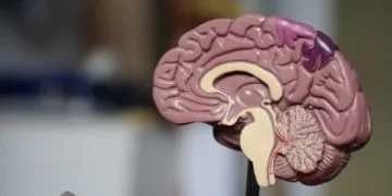 ما مذا إرتباط الصحة النفسية و الذاكرة، أعراض فقدان الذاكرة و كيف يمكن علاجها؟